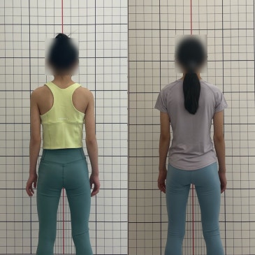 정렬선을 그어 나란히 놓은 뒷모습 자세평가 사진 두 장.